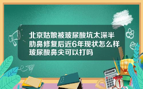 北京姑娘被玻尿酸坑太深半肋鼻修复后近6年现状怎么样玻尿酸鼻尖可以打吗