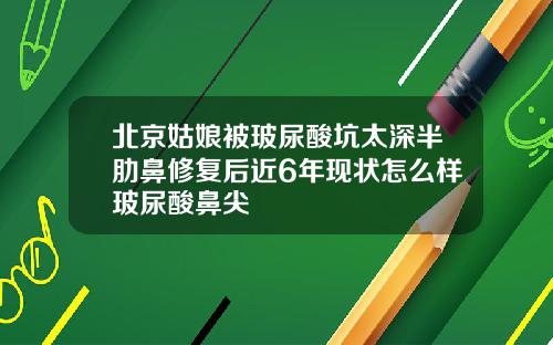 北京姑娘被玻尿酸坑太深半肋鼻修复后近6年现状怎么样玻尿酸鼻尖