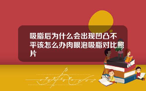 吸脂后为什么会出现凹凸不平该怎么办肉眼泡吸脂对比照片