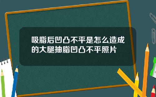 吸脂后凹凸不平是怎么造成的大腿抽脂凹凸不平照片