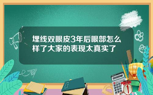 埋线双眼皮3年后眼部怎么样了大家的表现太真实了
