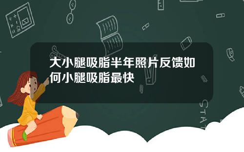 大小腿吸脂半年照片反馈如何小腿吸脂最快