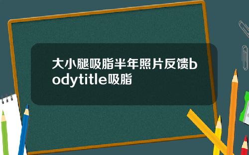 大小腿吸脂半年照片反馈bodytitle吸脂