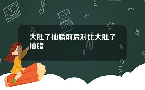 大肚子抽脂前后对比大肚子抽脂