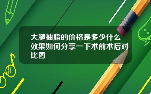 大腿抽脂的价格是多少什么效果如何分享一下术前术后对比图