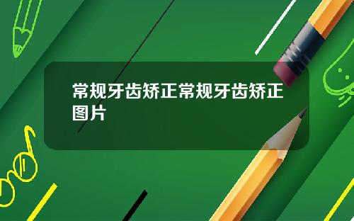 常规牙齿矫正常规牙齿矫正图片