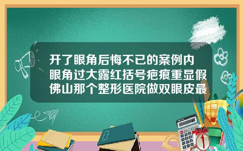 开了眼角后悔不已的案例内眼角过大露红括号疤痕重显假佛山那个整形医院做双眼皮最好