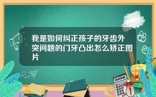 我是如何纠正孩子的牙齿外突问题的门牙凸出怎么矫正图片
