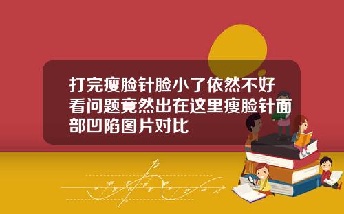 打完瘦脸针脸小了依然不好看问题竟然出在这里瘦脸针面部凹陷图片对比