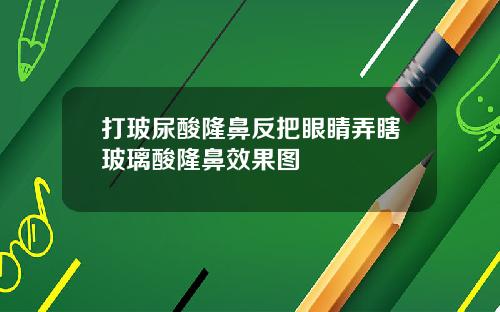 打玻尿酸隆鼻反把眼睛弄瞎玻璃酸隆鼻效果图