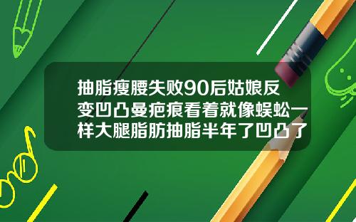 抽脂瘦腰失败90后姑娘反变凹凸曼疤痕看着就像蜈蚣一样大腿脂肪抽脂半年了凹凸了