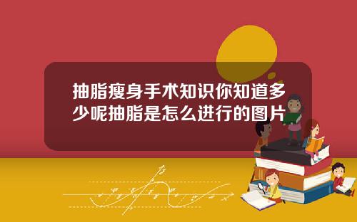 抽脂瘦身手术知识你知道多少呢抽脂是怎么进行的图片