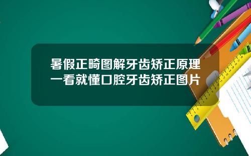 暑假正畸图解牙齿矫正原理一看就懂口腔牙齿矫正图片