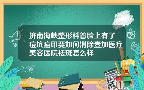 济南海峡整形科普脸上有了痘坑痘印要如何消除壹加医疗美容医院祛斑怎么样