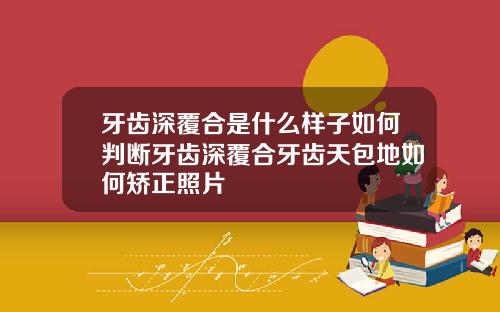 牙齿深覆合是什么样子如何判断牙齿深覆合牙齿天包地如何矫正照片