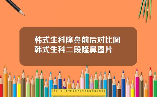 韩式生科隆鼻前后对比图 韩式生科二段隆鼻图片