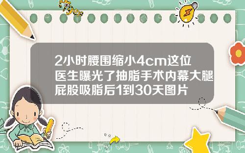 2小时腰围缩小4cm这位医生曝光了抽脂手术内幕大腿屁股吸脂后1到30天图片