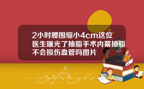 2小时腰围缩小4cm这位医生曝光了抽脂手术内幕抽脂不会损伤血管吗图片