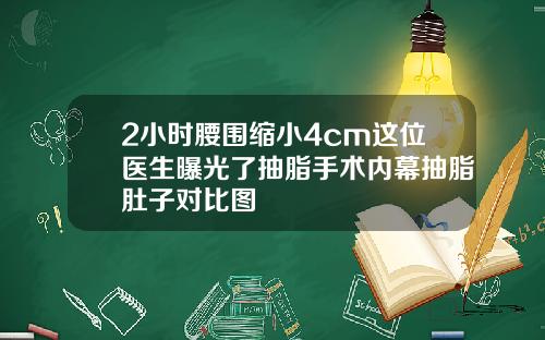 2小时腰围缩小4cm这位医生曝光了抽脂手术内幕抽脂肚子对比图