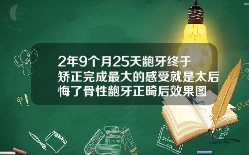 2年9个月25天龅牙终于矫正完成最大的感受就是太后悔了骨性龅牙正畸后效果图