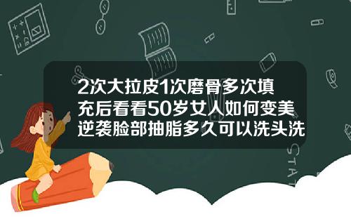 2次大拉皮1次磨骨多次填充后看看50岁女人如何变美逆袭脸部抽脂多久可以洗头洗澡