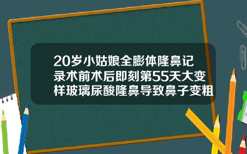20岁小姑娘全膨体隆鼻记录术前术后即刻第55天大变样玻璃尿酸隆鼻导致鼻子变粗了