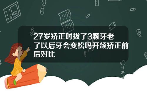 27岁矫正时拔了3颗牙老了以后牙会变松吗开颌矫正前后对比