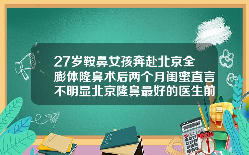 27岁鞍鼻女孩奔赴北京全膨体隆鼻术后两个月闺蜜直言不明显北京隆鼻最好的医生前十名