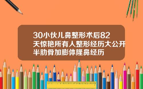 30小伙儿鼻整形术后82天惊艳所有人整形经历大公开半肋骨加膨体隆鼻经历