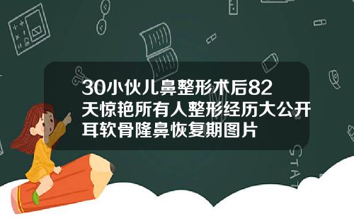 30小伙儿鼻整形术后82天惊艳所有人整形经历大公开耳软骨隆鼻恢复期图片