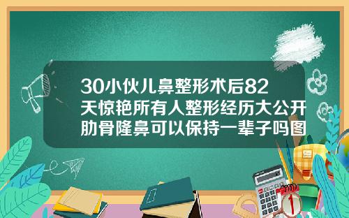 30小伙儿鼻整形术后82天惊艳所有人整形经历大公开肋骨隆鼻可以保持一辈子吗图片