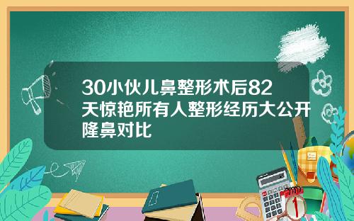 30小伙儿鼻整形术后82天惊艳所有人整形经历大公开隆鼻对比