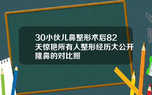 30小伙儿鼻整形术后82天惊艳所有人整形经历大公开隆鼻的对比照