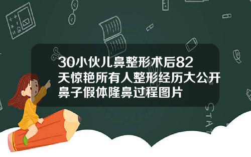 30小伙儿鼻整形术后82天惊艳所有人整形经历大公开鼻子假体隆鼻过程图片