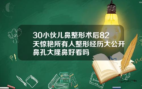 30小伙儿鼻整形术后82天惊艳所有人整形经历大公开鼻孔大隆鼻好看吗