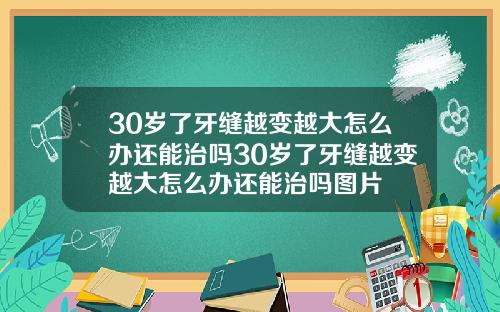 30岁了牙缝越变越大怎么办还能治吗30岁了牙缝越变越大怎么办还能治吗图片
