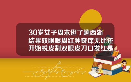 30岁女子周末逛了趟西湖结果双眼眼周红肿奇痒无比还开始蜕皮割双眼皮刀口发红是怎么了呢