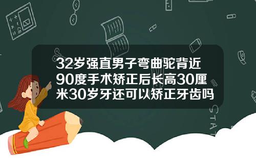 32岁强直男子弯曲驼背近90度手术矫正后长高30厘米30岁牙还可以矫正牙齿吗