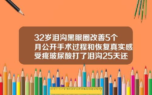 32岁泪沟黑眼圈改善5个月公开手术过程和恢复真实感受疼玻尿酸打了泪沟25天还肿