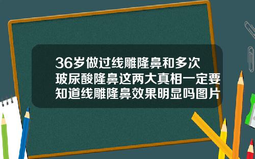 36岁做过线雕隆鼻和多次玻尿酸隆鼻这两大真相一定要知道线雕隆鼻效果明显吗图片