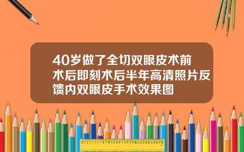 40岁做了全切双眼皮术前术后即刻术后半年高清照片反馈内双眼皮手术效果图