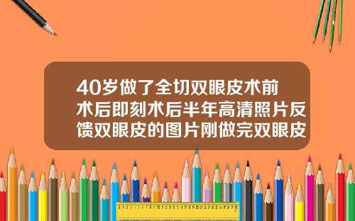 40岁做了全切双眼皮术前术后即刻术后半年高清照片反馈双眼皮的图片刚做完双眼皮的图片