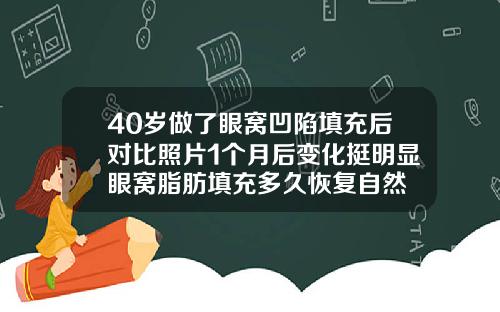 40岁做了眼窝凹陷填充后对比照片1个月后变化挺明显眼窝脂肪填充多久恢复自然