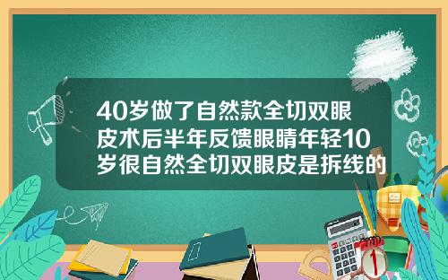 40岁做了自然款全切双眼皮术后半年反馈眼睛年轻10岁很自然全切双眼皮是拆线的好还是免拆线的好