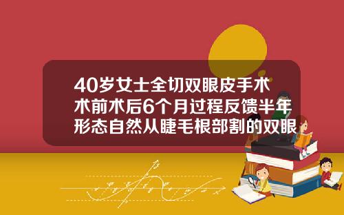 40岁女士全切双眼皮手术术前术后6个月过程反馈半年形态自然从睫毛根部割的双眼皮恢复期