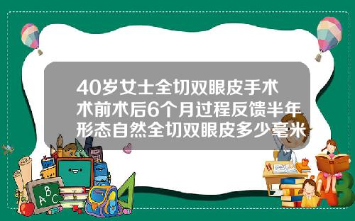 40岁女士全切双眼皮手术术前术后6个月过程反馈半年形态自然全切双眼皮多少毫米最自然好看