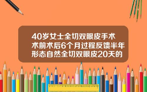 40岁女士全切双眼皮手术术前术后6个月过程反馈半年形态自然全切双眼皮20天的状态