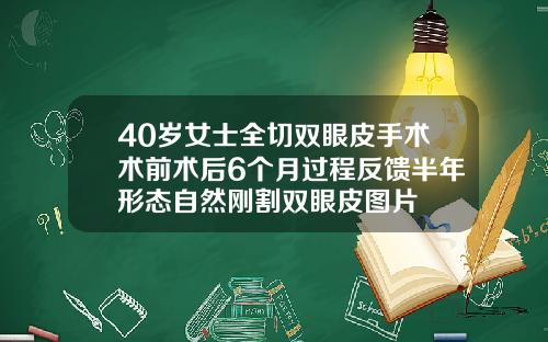 40岁女士全切双眼皮手术术前术后6个月过程反馈半年形态自然刚割双眼皮图片
