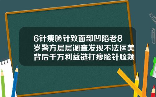 6针瘦脸针致面部凹陷老8岁警方层层调查发现不法医美背后千万利益链打瘦脸针脸颊凹陷图片