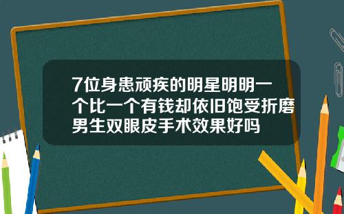 7位身患顽疾的明星明明一个比一个有钱却依旧饱受折磨男生双眼皮手术效果好吗